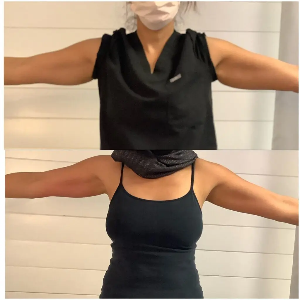 Cryo body sculpting treatment room at Eastside Microblading & Beauty