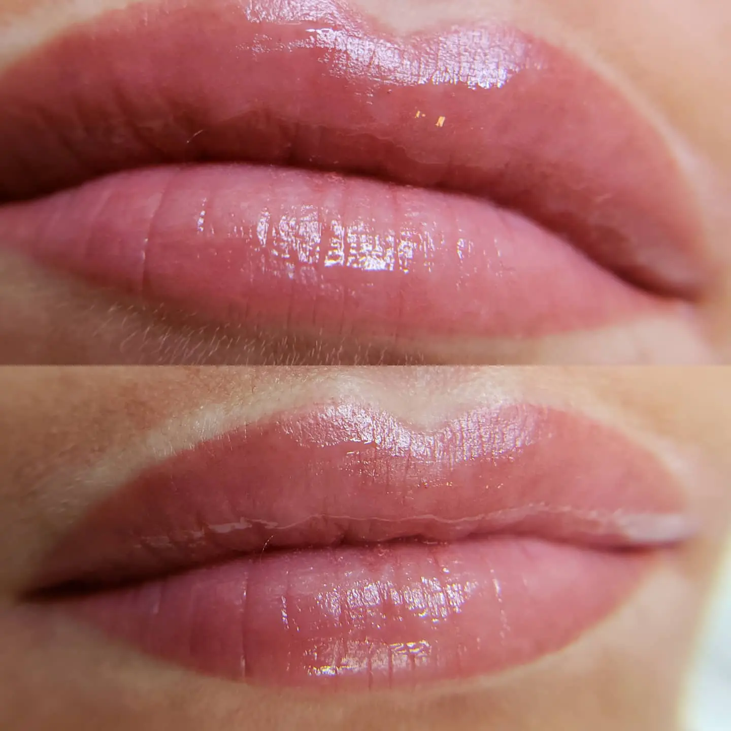 Close-up comparison of lip blush results