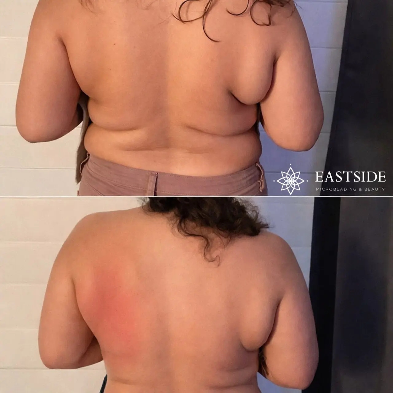 Back: Eastside cryo client before and after