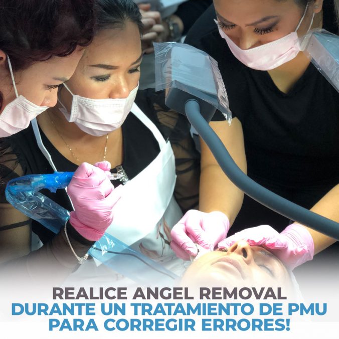 04-perform-angel-removal-during-a-pmu-treatment-1-676x676