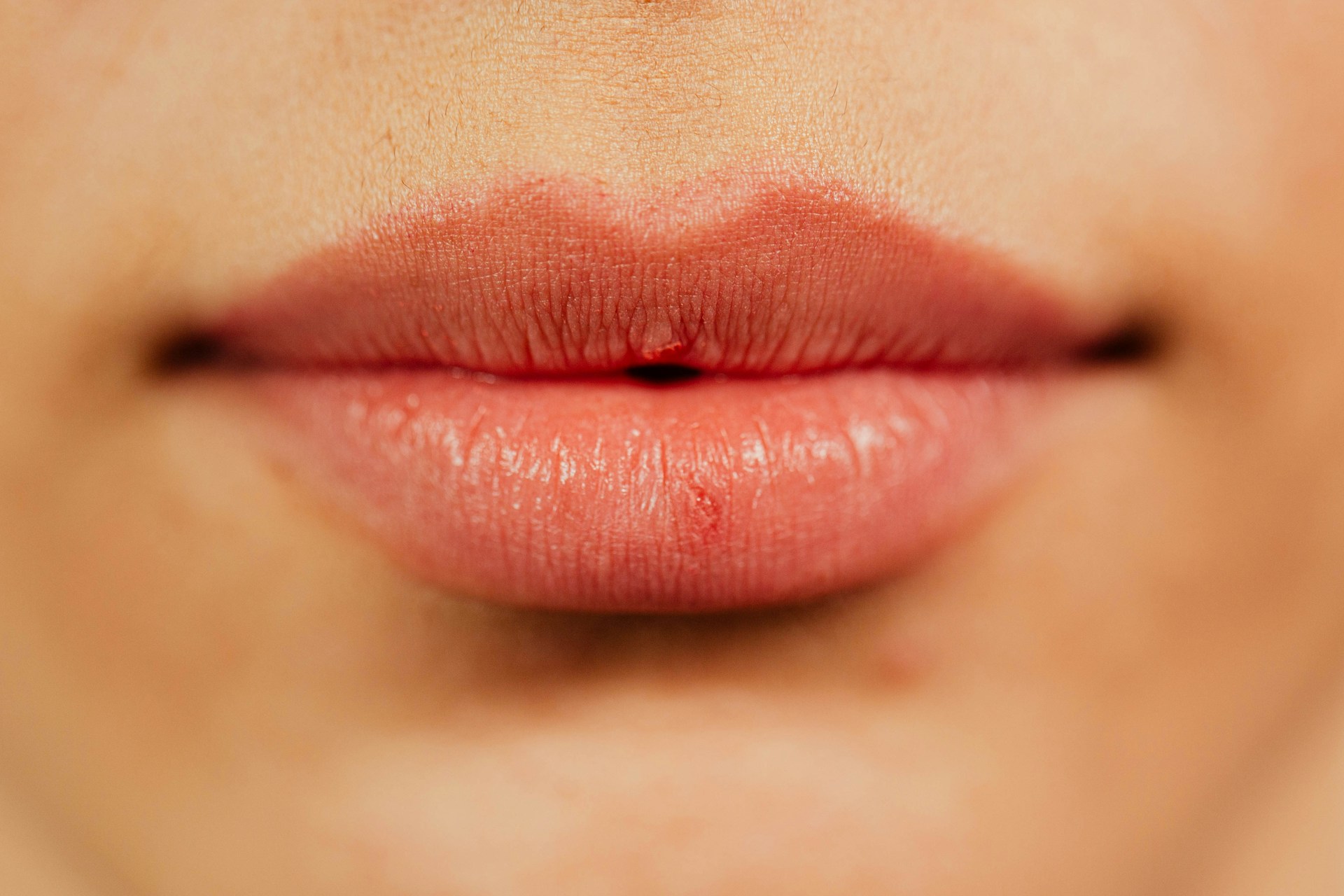 Lips