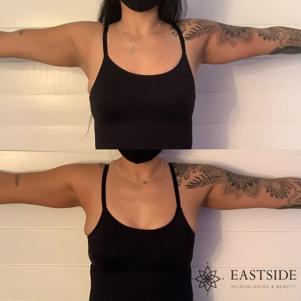 Cryo body sculpting treatment room at Eastside Microblading & Beauty