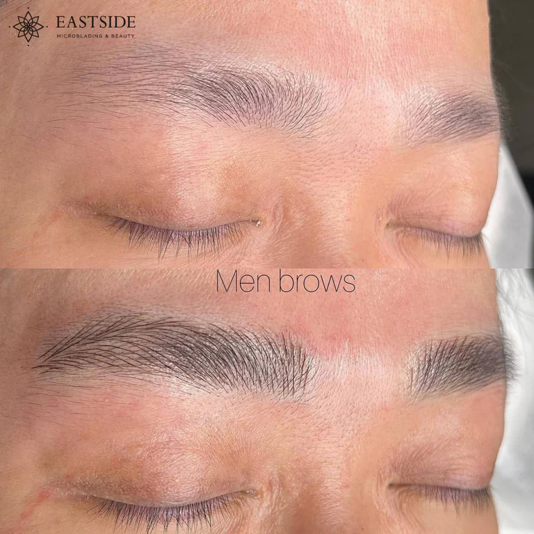 Eastside client result: men's brows