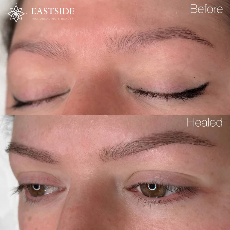 Eastside client result: nano brows, powder brows