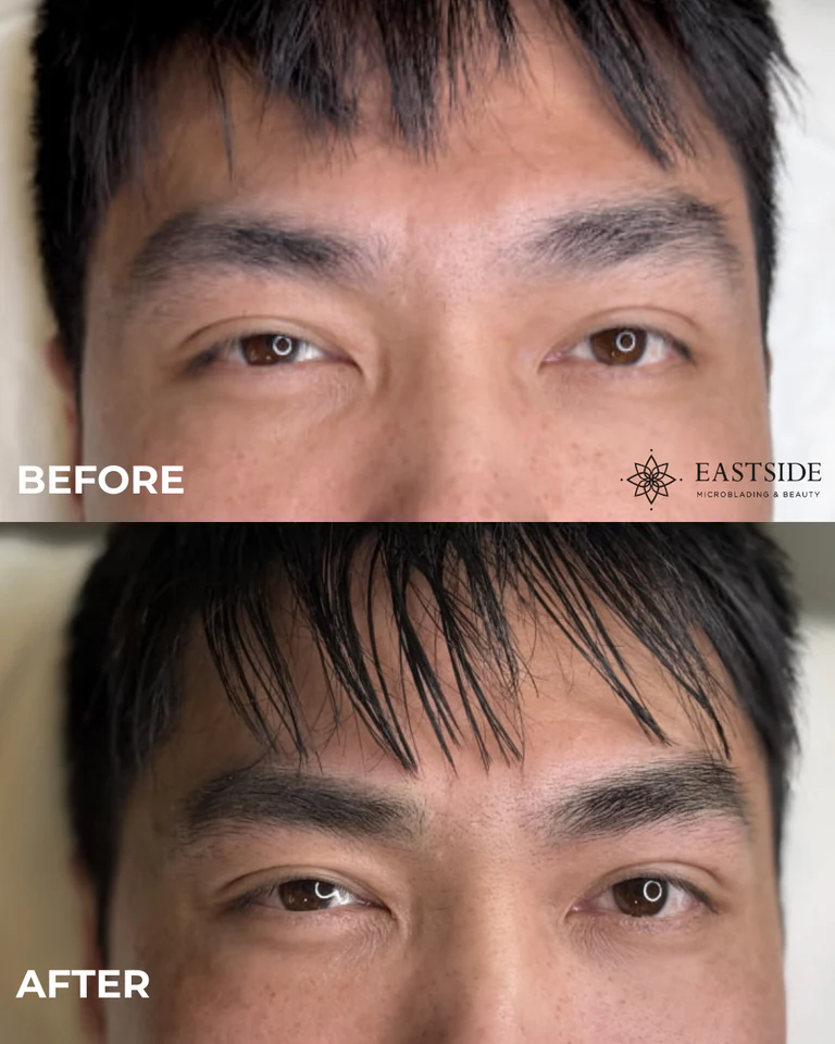 Eastside client result: men's brows