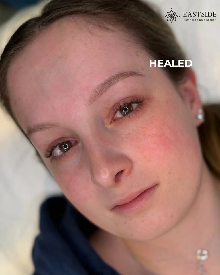 Eastside client result: nano brows, powder brows